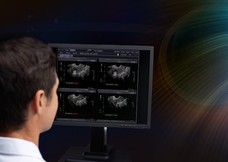 Sonographer reviews ultrasound images